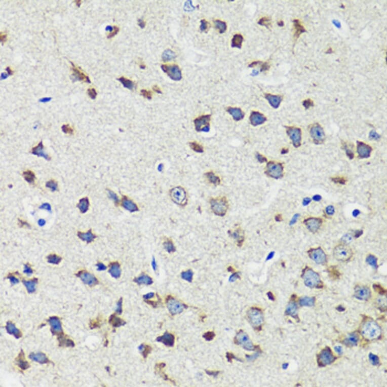 Immunohistochemistry - Anti-CCDC124 Antibody (A92024) - Antibodies.com