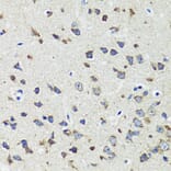 Immunohistochemistry - Anti-CCDC124 Antibody (A92024) - Antibodies.com
