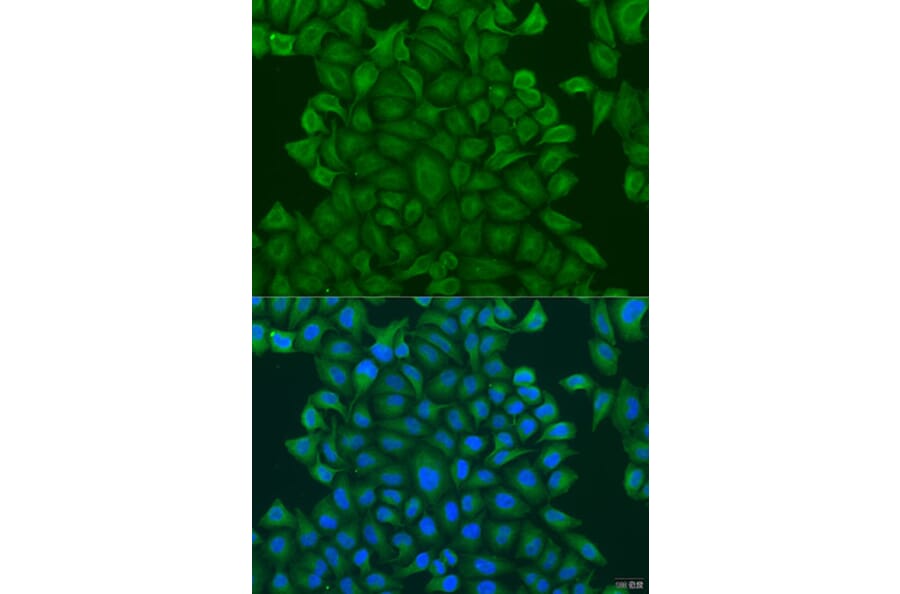 Immunofluorescence - Anti-GSTM3 Antibody (A15062) - Antibodies.com