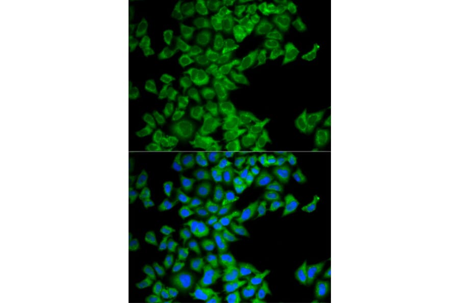 Immunofluorescence - Anti-DIABLO Antibody (A13432) - Antibodies.com