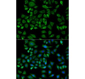 Immunofluorescence - Anti-Haptoglobin Antibody (A92029) - Antibodies.com