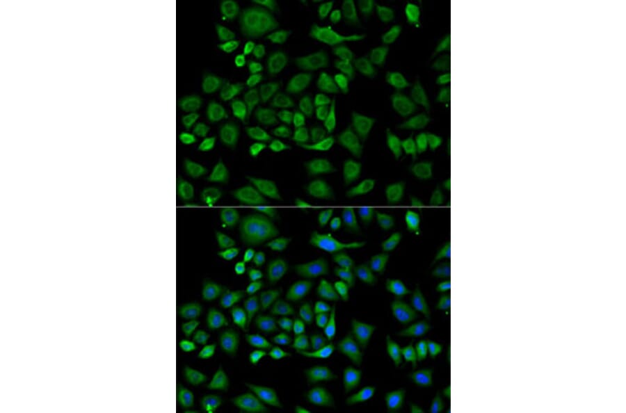 Immunofluorescence - Anti-Haptoglobin Antibody (A92029) - Antibodies.com