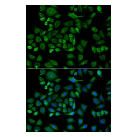 Immunofluorescence - Anti-Haptoglobin Antibody (A92029) - Antibodies.com