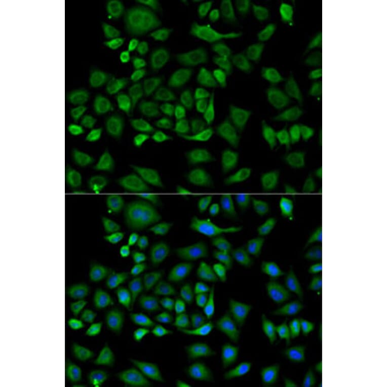 Immunofluorescence - Anti-Haptoglobin Antibody (A92029) - Antibodies.com