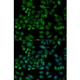 Immunofluorescence - Anti-Haptoglobin Antibody (A92029) - Antibodies.com