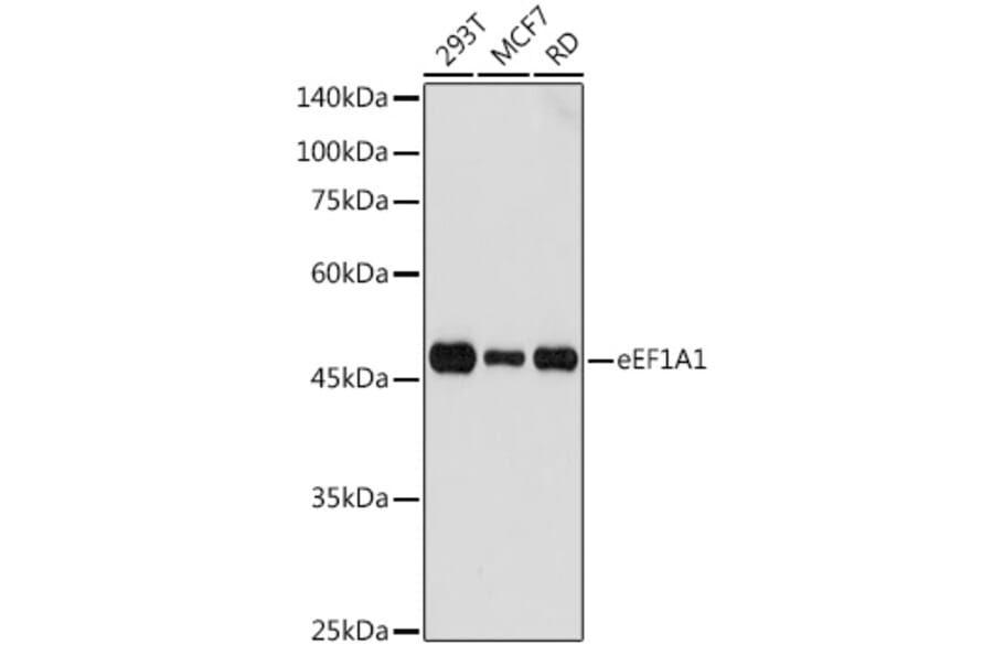Western Blot - Anti-eEF1A1/EF-Tu Antibody (A92031) - Antibodies.com