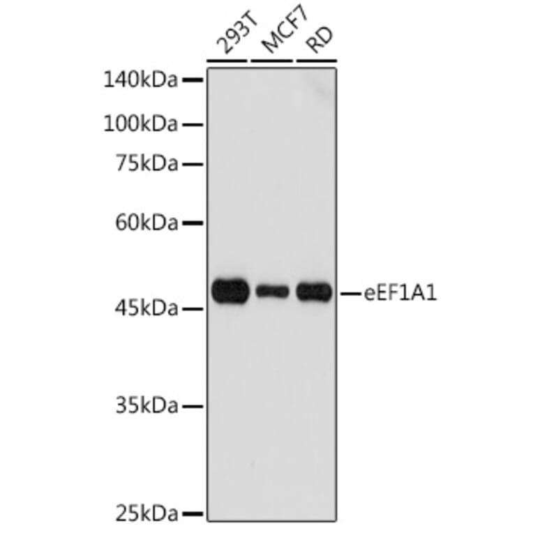 Western Blot - Anti-eEF1A1/EF-Tu Antibody (A92031) - Antibodies.com