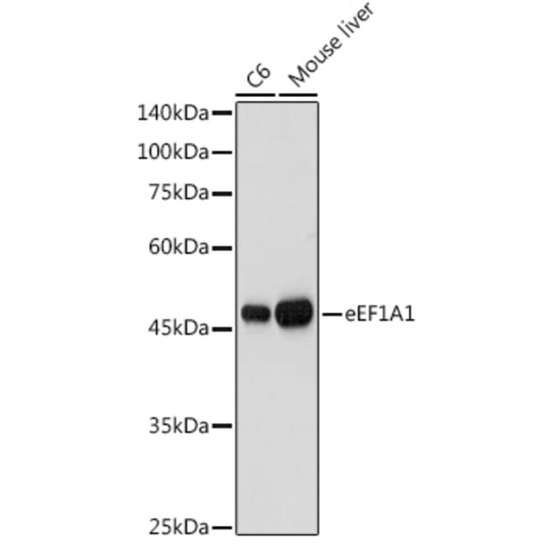 Western Blot - Anti-eEF1A1/EF-Tu Antibody (A92031) - Antibodies.com