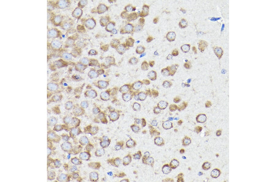 Immunohistochemistry - Anti-eEF1A1/EF-Tu Antibody (A92031) - Antibodies.com