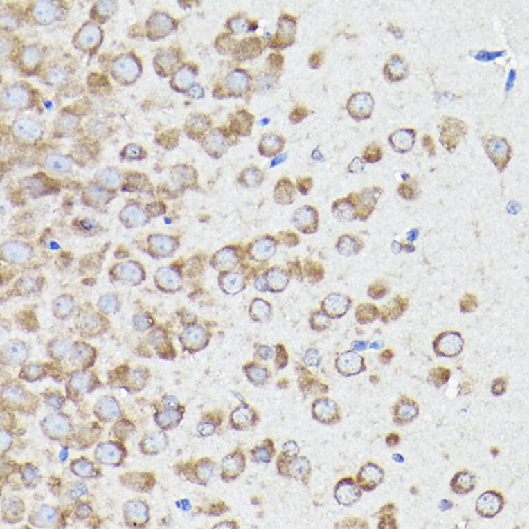 Immunohistochemistry - Anti-eEF1A1/EF-Tu Antibody (A92031) - Antibodies.com