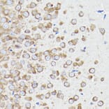 Immunohistochemistry - Anti-eEF1A1/EF-Tu Antibody (A92031) - Antibodies.com