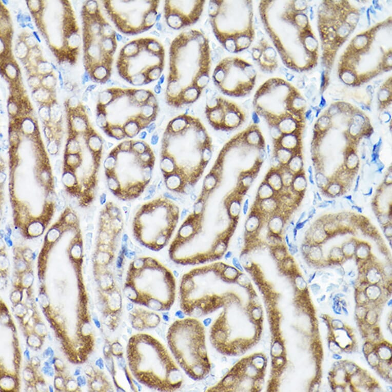 Immunohistochemistry - Anti-eEF1A1/EF-Tu Antibody (A92031) - Antibodies.com