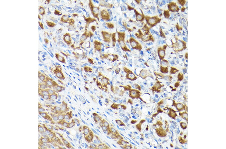 Immunohistochemistry - Anti-eEF1A1/EF-Tu Antibody (A92031) - Antibodies.com
