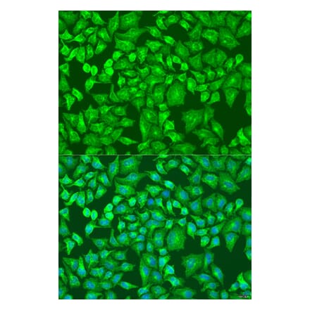 Immunofluorescence - Anti-Dishevelled 2 Antibody (A92033) - Antibodies.com