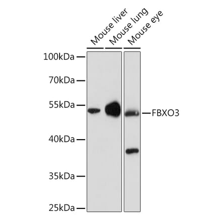 Western Blot - Anti-FBXO3 Antibody (A92034) - Antibodies.com