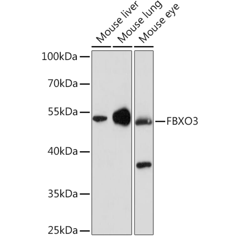 Western Blot - Anti-FBXO3 Antibody (A92034) - Antibodies.com