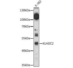 Western Blot - Anti-KLHDC2 Antibody (A92035) - Antibodies.com