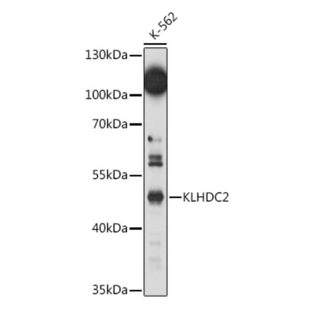 Western Blot - Anti-KLHDC2 Antibody (A92035) - Antibodies.com