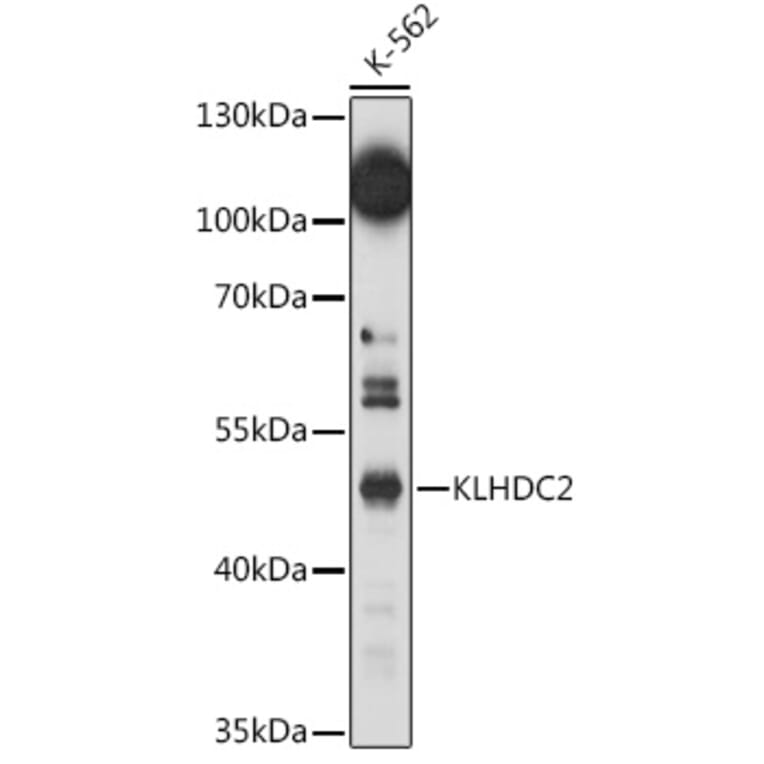 Western Blot - Anti-KLHDC2 Antibody (A92035) - Antibodies.com