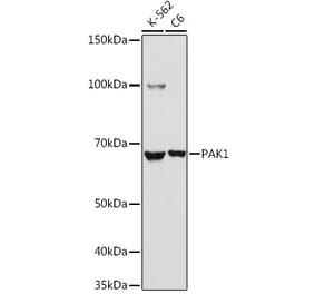 Western Blot - Anti-PAK1 Antibody (A92036) - Antibodies.com