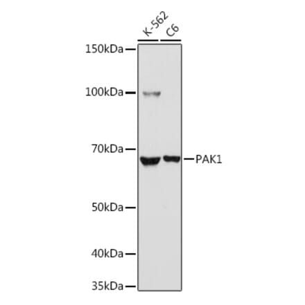 Western Blot - Anti-PAK1 Antibody (A92036) - Antibodies.com