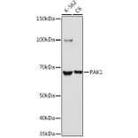 Western Blot - Anti-PAK1 Antibody (A92036) - Antibodies.com