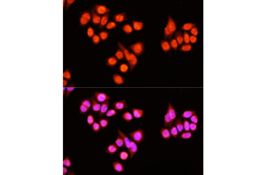 Immunofluorescence - Anti-ZNF408 Antibody (A92037) - Antibodies.com