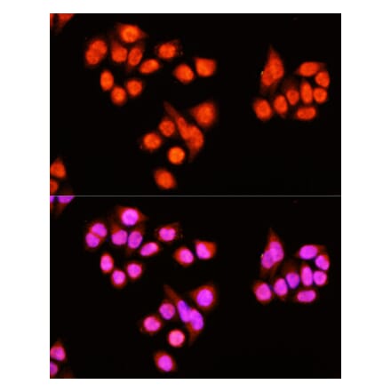 Immunofluorescence - Anti-ZNF408 Antibody (A92037) - Antibodies.com