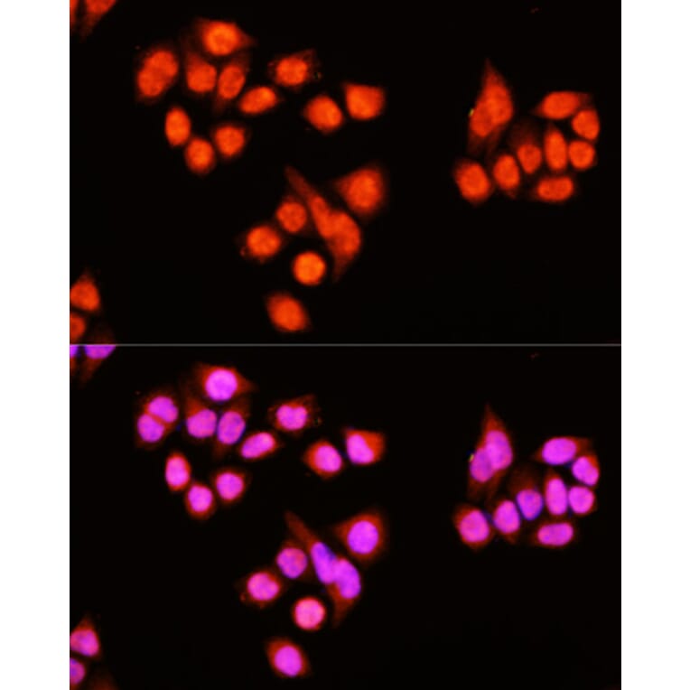 Immunofluorescence - Anti-ZNF408 Antibody (A92037) - Antibodies.com