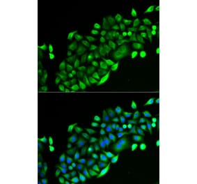 Immunofluorescence - Anti-GSTO2 Antibody (A92039) - Antibodies.com
