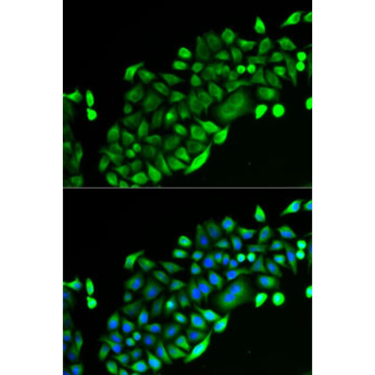 Immunofluorescence - Anti-GSTO2 Antibody (A92039) - Antibodies.com