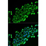 Immunofluorescence - Anti-GSTO2 Antibody (A92039) - Antibodies.com