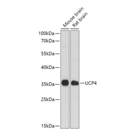Western Blot - Anti-UCP4 Antibody (A92042) - Antibodies.com