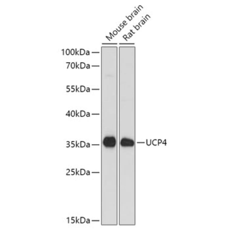 Western Blot - Anti-UCP4 Antibody (A92042) - Antibodies.com