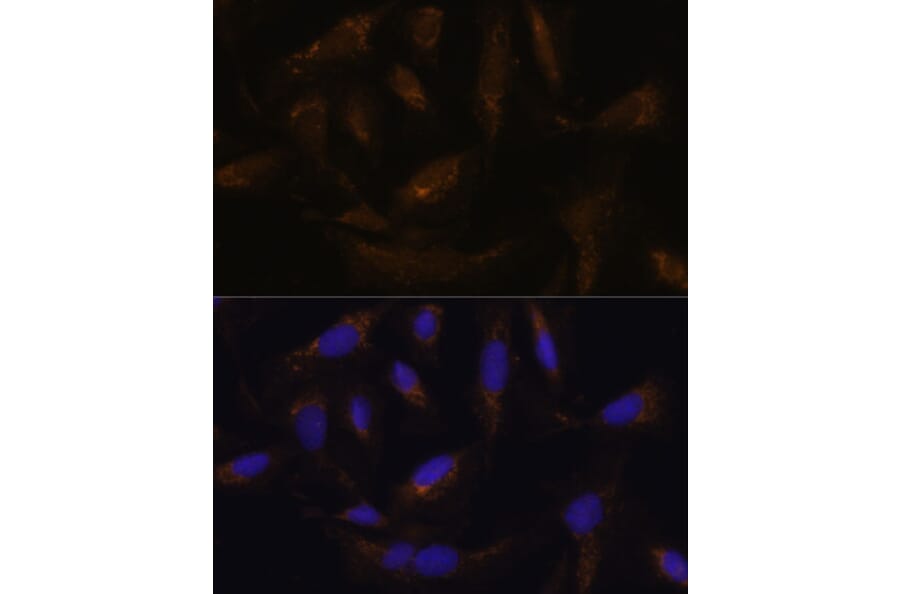 Immunofluorescence - Anti-UCP4 Antibody (A92042) - Antibodies.com