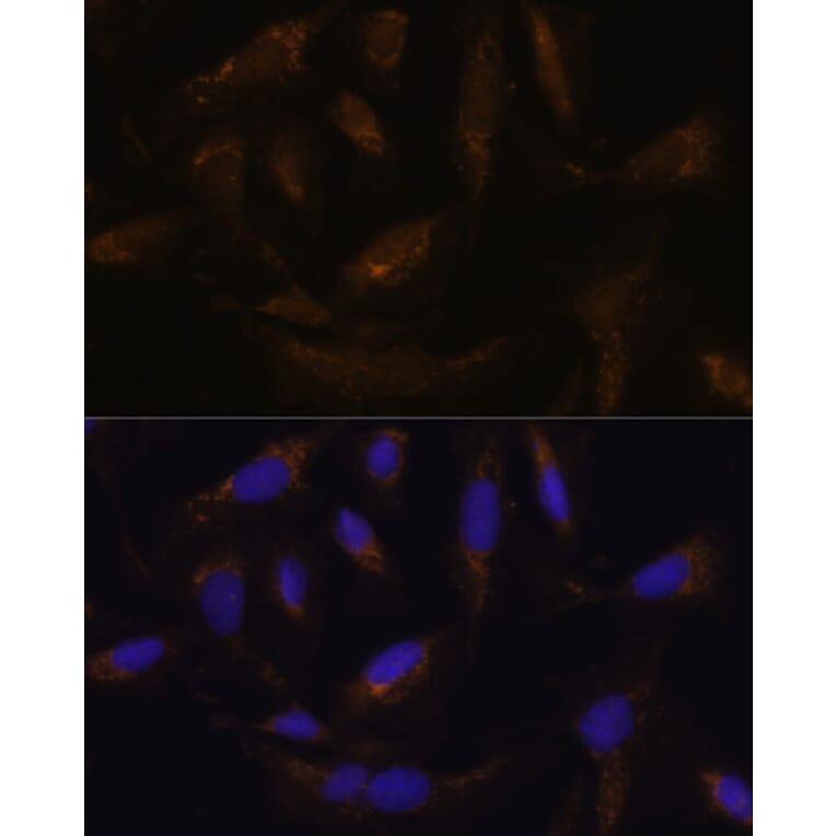 Immunofluorescence - Anti-UCP4 Antibody (A92042) - Antibodies.com