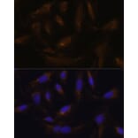 Immunofluorescence - Anti-UCP4 Antibody (A92042) - Antibodies.com