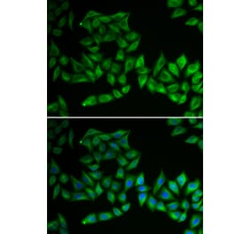 Immunofluorescence - Anti-TPMT Antibody (A92043) - Antibodies.com