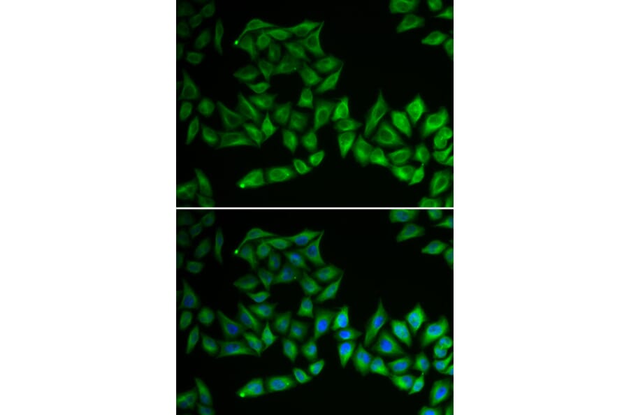 Immunofluorescence - Anti-TPMT Antibody (A92043) - Antibodies.com