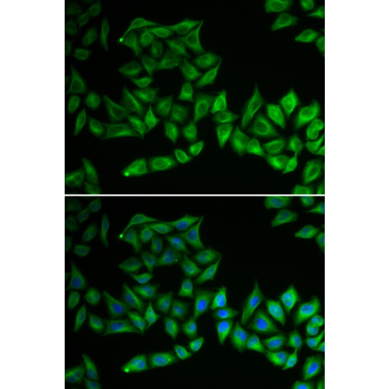 Immunofluorescence - Anti-TPMT Antibody (A92043) - Antibodies.com