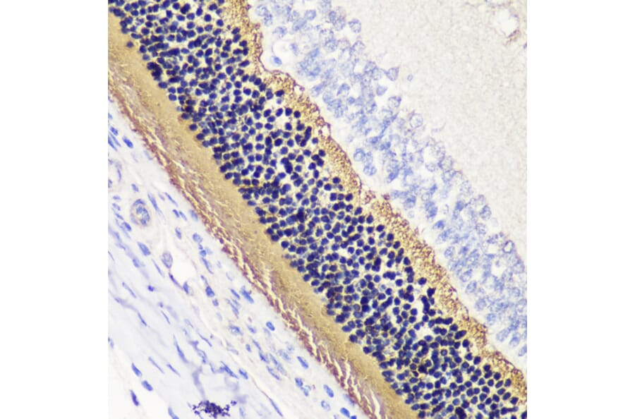 Immunohistochemistry - Anti-PHOS/PDC Antibody (A92044) - Antibodies.com