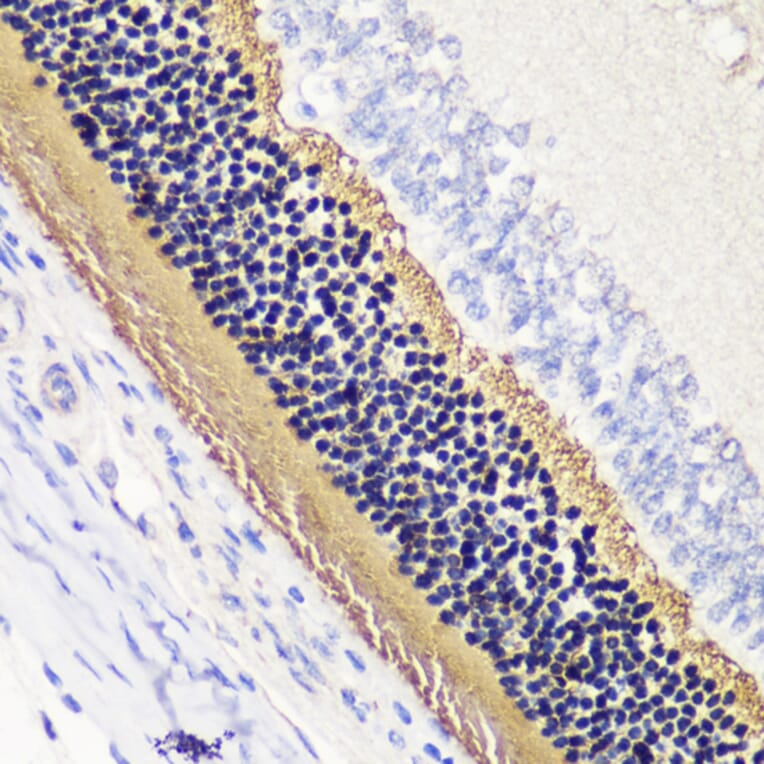 Immunohistochemistry - Anti-PHOS/PDC Antibody (A92044) - Antibodies.com