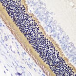 Immunohistochemistry - Anti-PHOS/PDC Antibody (A92044) - Antibodies.com