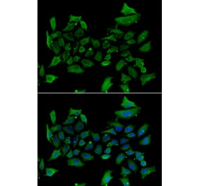 Immunofluorescence - Anti-ALAS1 Antibody (A92045) - Antibodies.com