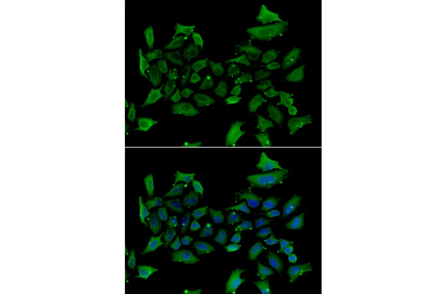 Immunofluorescence - Anti-ALAS1 Antibody (A92045) - Antibodies.com