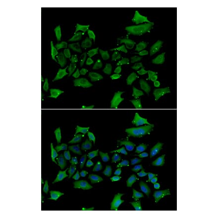 Immunofluorescence - Anti-ALAS1 Antibody (A92045) - Antibodies.com