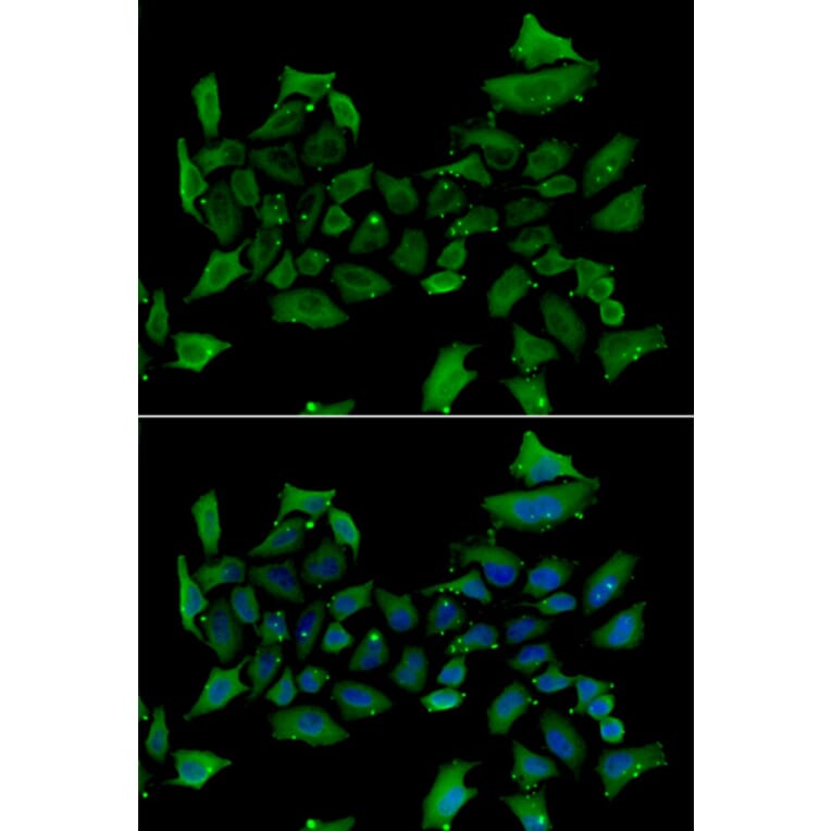 Immunofluorescence - Anti-ALAS1 Antibody (A92045) - Antibodies.com