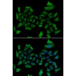 Immunofluorescence - Anti-ALAS1 Antibody (A92045) - Antibodies.com