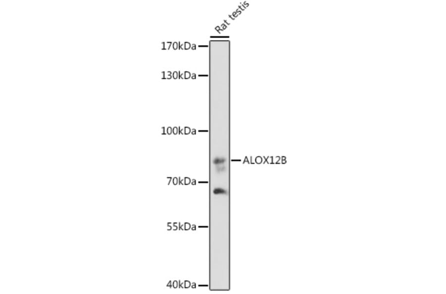 Western Blot - Anti-ALOX12B Antibody (A92046) - Antibodies.com