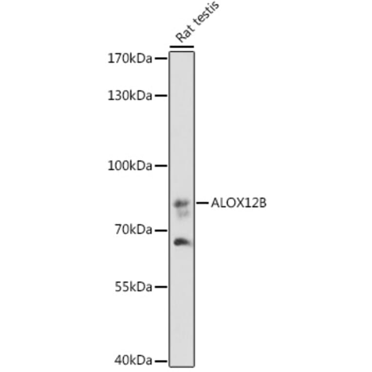 Western Blot - Anti-ALOX12B Antibody (A92046) - Antibodies.com